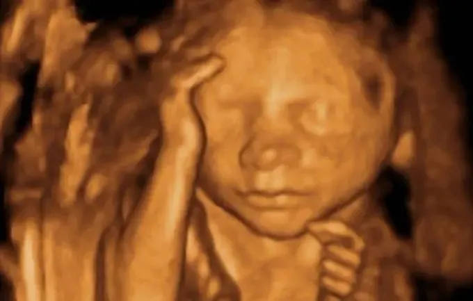 Realistic,Portrait Photography,Girl,Other,SD 1.5