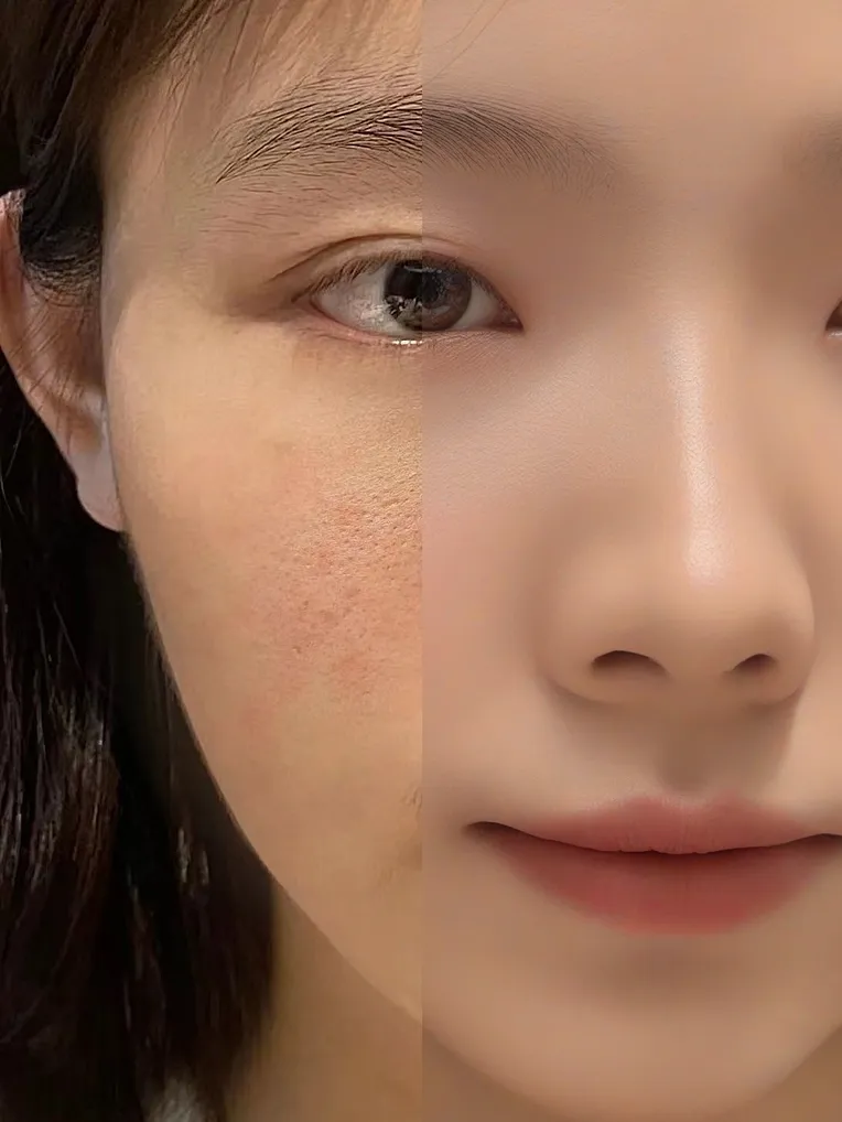 Realistic,Portrait Photography,Girl,LoRA,SDXL